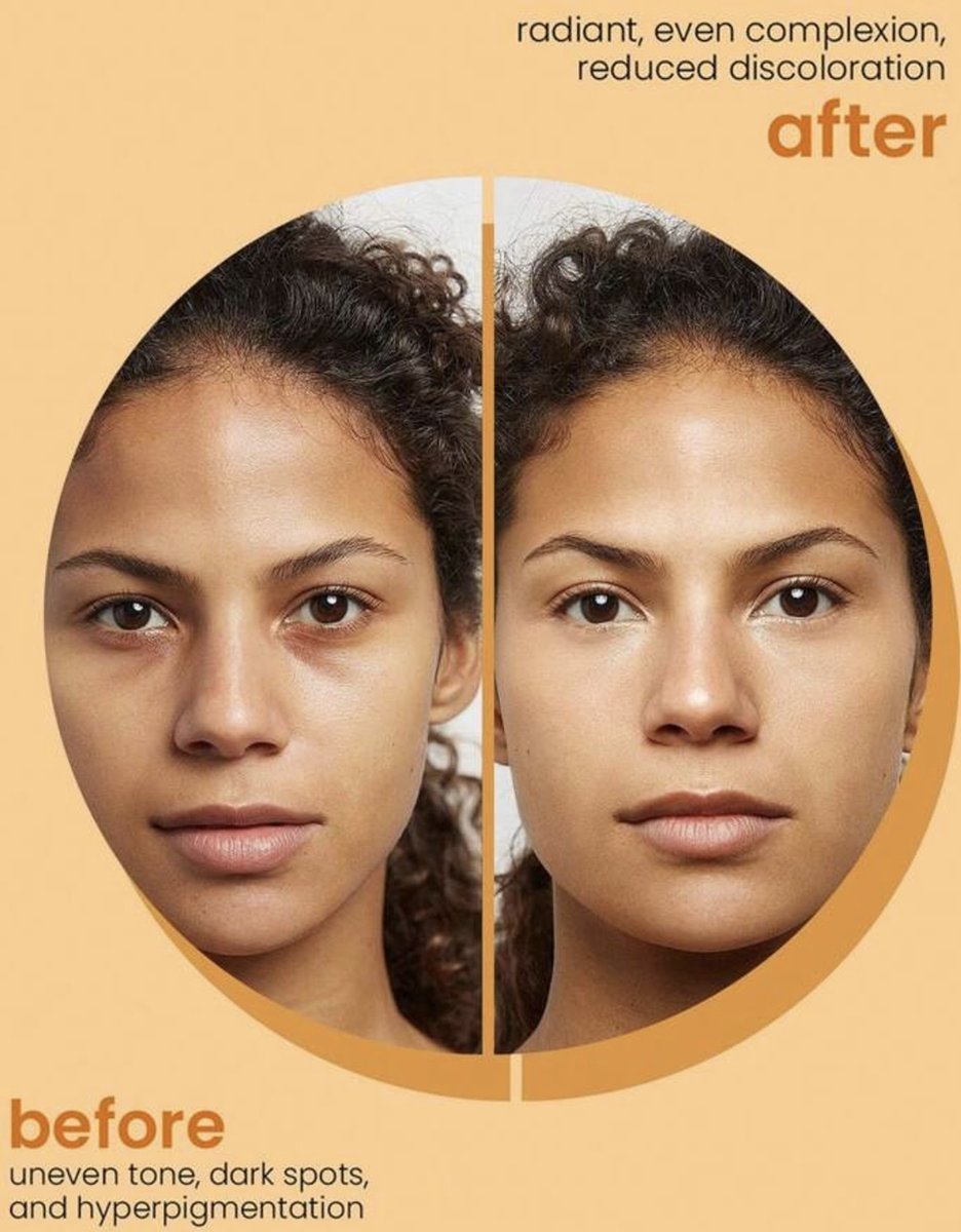 Turmeric & Kojic Acid - Skin Brightening Soap